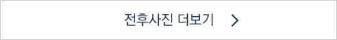 전후사진더보기