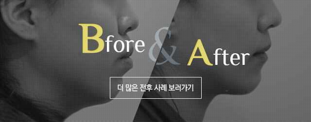 전후사례